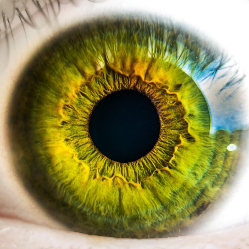 Iridologia